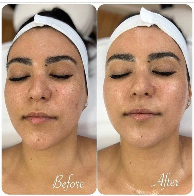 Basic Facial