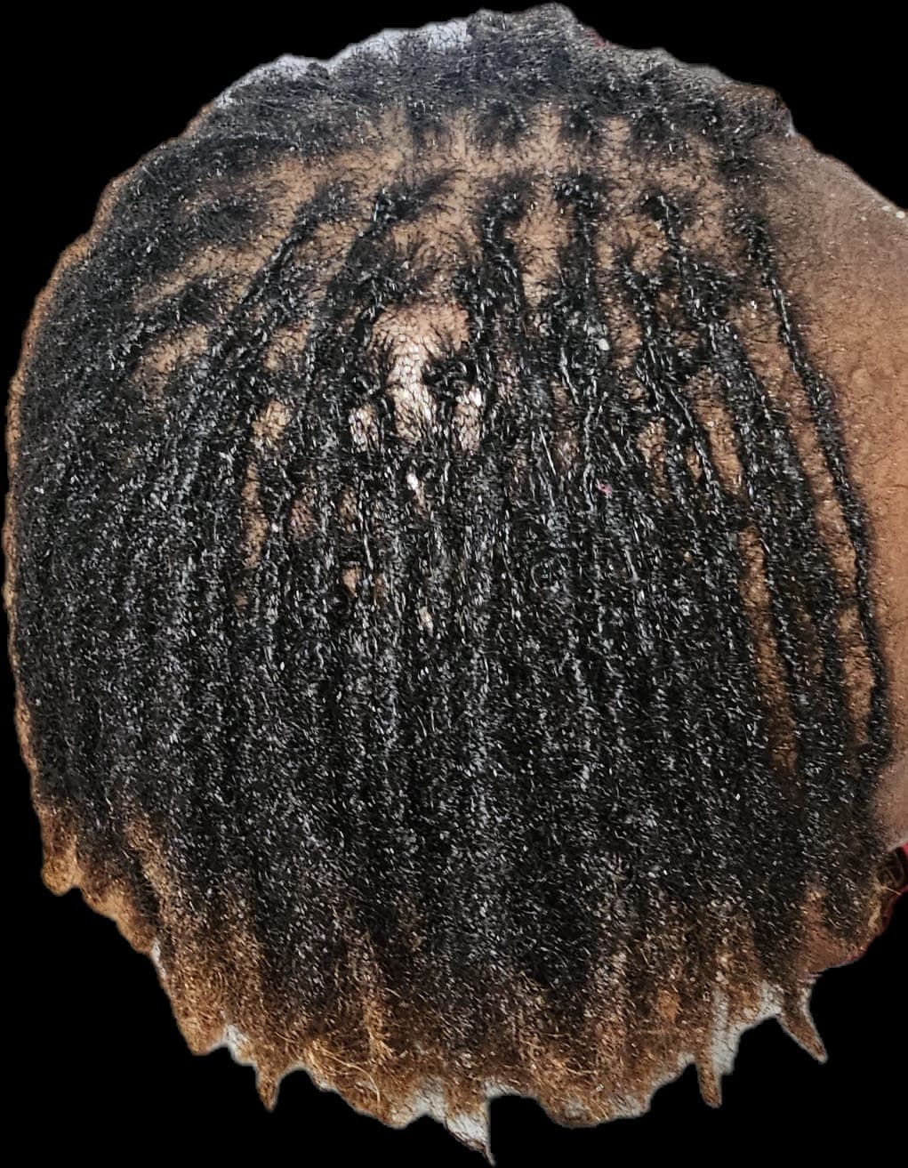 InterLocs